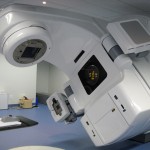 cancro radioterapia